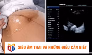 Siêu âm thai và những điều cần biết