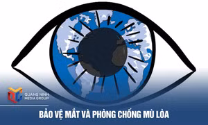 Bảo vệ mắt và phòng chống mù lòa