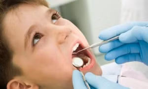 Cách xử trí khi trẻ bị chảy máu chân răng