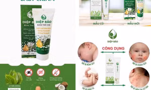 Cục Dược thông tin về kem bôi da trẻ em sản xuất tại Việt Nam bị Mỹ thu hồi