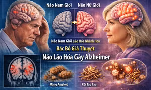 Nghiên cứu mới bác bỏ giả thuyết não bộ lão hóa nhanh hơn gây Alzheimer