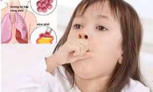 6 cách bảo vệ trẻ không bị ốm khi trời trở lạnh