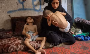 Hàng nghìn trẻ em ở Gaza nhập viện vì suy dinh dưỡng cấp tính
