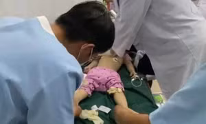 Từ vụ bé 3 tuổi tử vong vì sặc thức ăn ở nhà trẻ, bác sĩ nêu cách xử trí đúng ngay tại chỗ