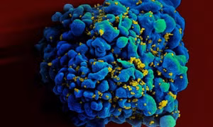Anh phát hiện chủng HIV lây lan nhanh và nguy hiểm hơn