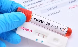 Công ty Y tế Đức Minh bán kit xét nghiệm COVID-19 chênh lệch giá trên 100%