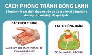Cách phòng tránh bỏng lạnh trong thời tiết giá rét