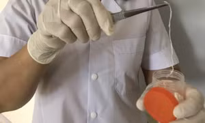 Con giun rồng ký sinh trong đùi người đàn ông