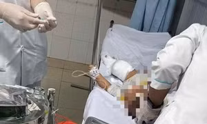 Ném bom xăng vào nhà khiến 3 người bị thương