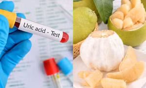 Tác dụng của ăn bưởi tới người có chỉ số axit uric cao