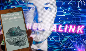 Hàng nghìn người đăng ký cấy chip não của Neuralink