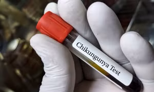 Mỹ phê duyệt vaccine đầu tiên trên thế giới ngừa virus Chikungunya
