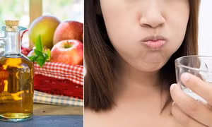 Chuyên gia dinh dưỡng cảnh báo 9 tác hại của giấm táo khi uống quá nhiều