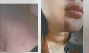 Vụ nữ sinh lớp 12 bị nhóm phụ huynh đánh hội đồng: Nhà trường lên tiếng