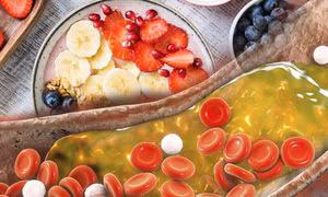 Những thực phẩm kiểm soát mức cholesterol một cách tự nhiên