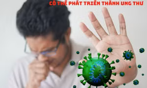 5 bệnh viêm nhiễm phổ biến có thể phát triển thành ung thư