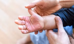 Cảnh giác với những tai nạn thường gặp ở trẻ nhỏ