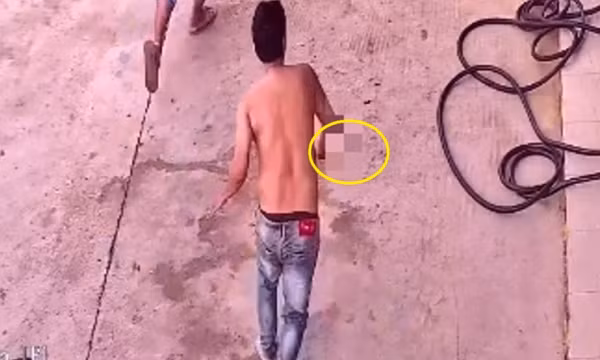 Đối tượng dùng kéo đâm nhân viên cây xăng có biểu hiện tâm thần