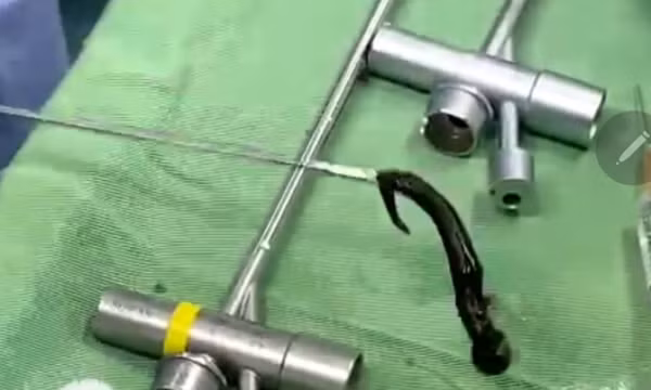 Vắt rừng ký sinh trong đường thở bé 6 tuổi