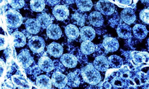 Người nhiễm Omicron ít bị nhiễm biến thể khác nếu đã tiêm vaccine