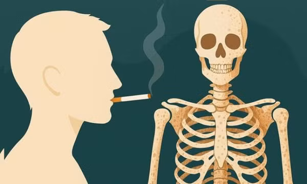 Thói quen xấu âm thầm bào mòn bộ khung nâng đỡ cơ thể