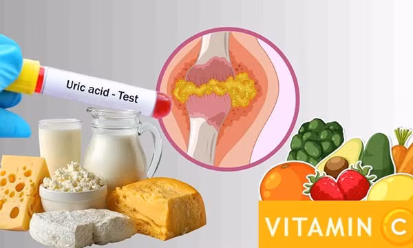 6 thực phẩm giúp chuyển hóa axit uric, giảm sự khó chịu do bệnh gút