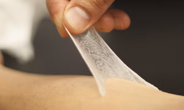 Phát triển miếng dán sợi nano giúp chữa lành vết thương