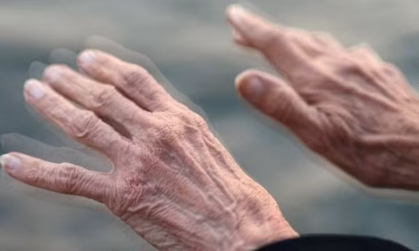 Phát triển bút thông minh chẩn đoán bệnh Parkinson