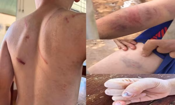Vụ cháu bé 9 tuổi bị đánh đập ở Đắk Lắk: Khởi tố bà nội và cha ruột