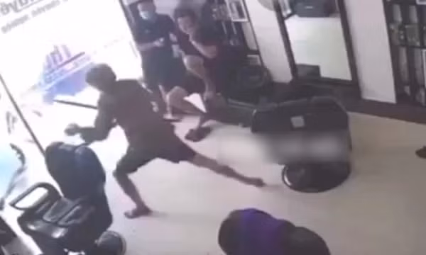 Thanh niên bị chém lìa bàn tay ở tiệm cắt tóc