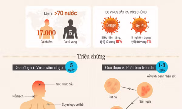 Cách bảo vệ bản thân không mắc đậu mùa khỉ
