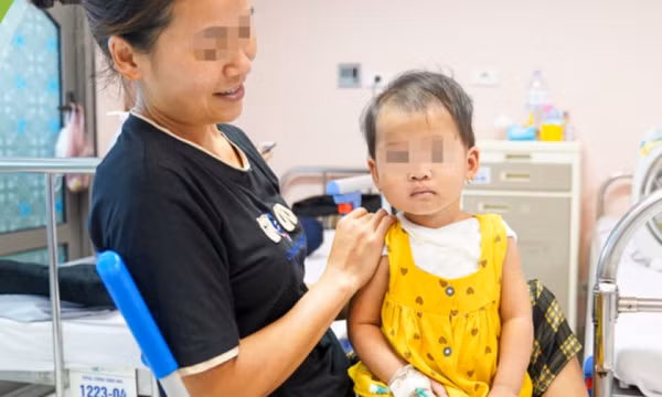 Trẻ nguy kịch do chữa bỏng sai: Bác sĩ gợi ý cách sơ cứu chuẩn nhất