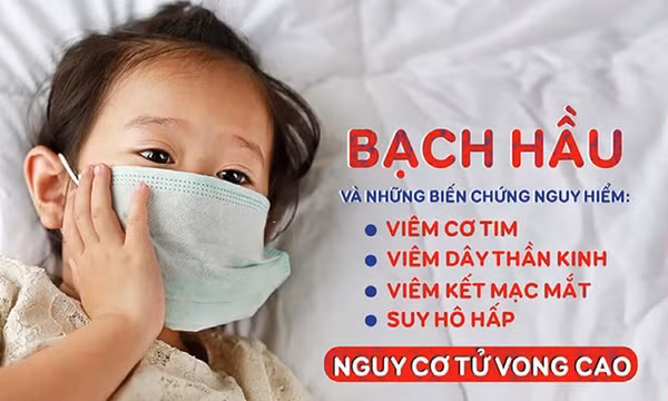 Thủ tướng yêu cầu chủ động kiểm soát, ngăn chặn, không để lây lan, bùng phát bệnh bạch hầu