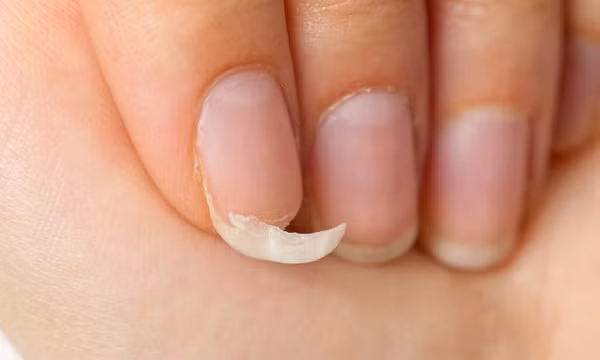 Dấu hiệu cơ thể 'kêu cứu' vì đang thiếu canxi