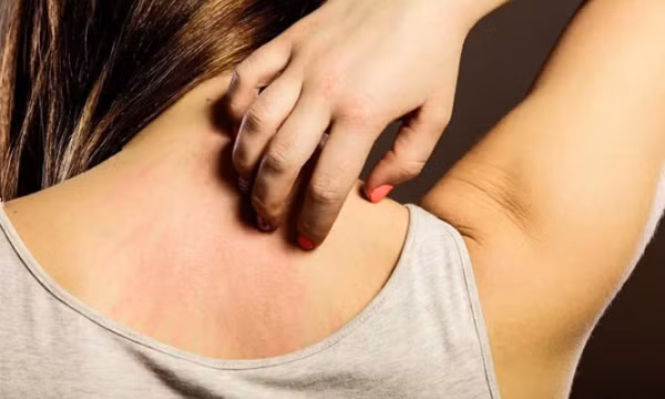 Biểu hiện trên da cảnh báo ung thư tuyến tụy