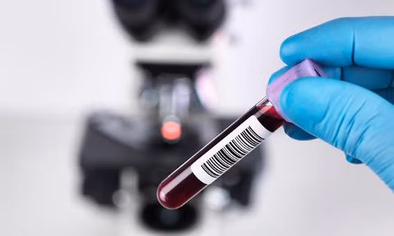 Sau tiêm 2 mũi vaccine COVID-19, có cần làm xét nghiệm kháng thể?