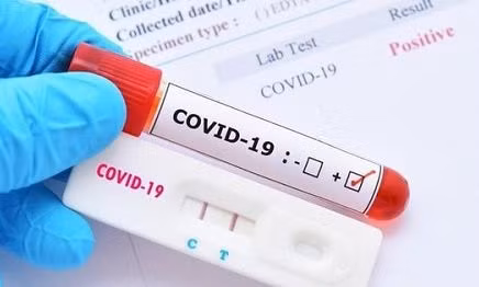 Miễn thuế nhập khẩu vật tư sản xuất que test COVID-19
