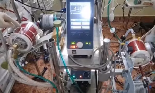 Cải tiến máy ECMO cứu cùng lúc 2 bệnh nhân COVID-19