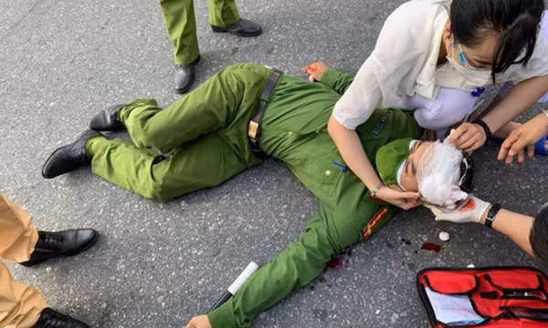 Nam sinh thông chốt kiểm soát, tông xe khiến cảnh sát bị thương, nhập viện