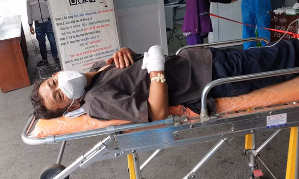 Người đàn ông bị chém lìa bàn tay ở Bình Dương