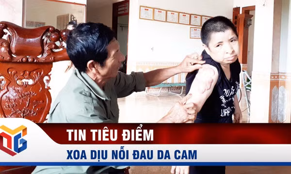 Xoa dịu nỗi đau da cam