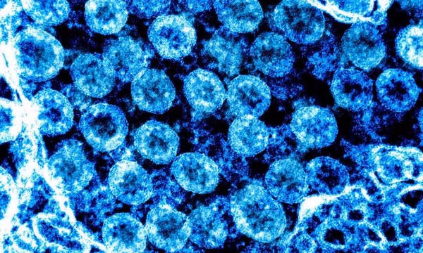 Virus SARS-CoV-2 thay đổi hình dạng để tăng khả năng sống sót