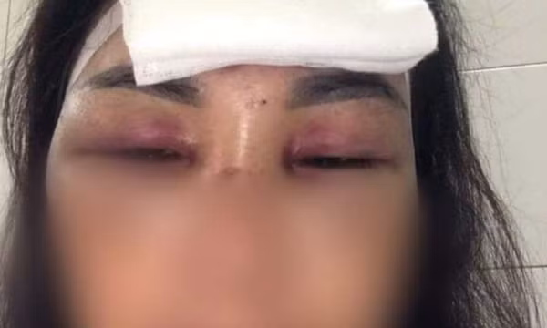 Công an Hải Dương điều tra đơn vợ tố chồng chích điện, dìm xuống ao lúc nửa đêm