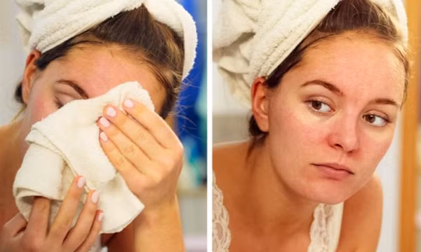 Tác hại ghê gớm của thói quen dùng khăn lau khô sau khi rửa mặt