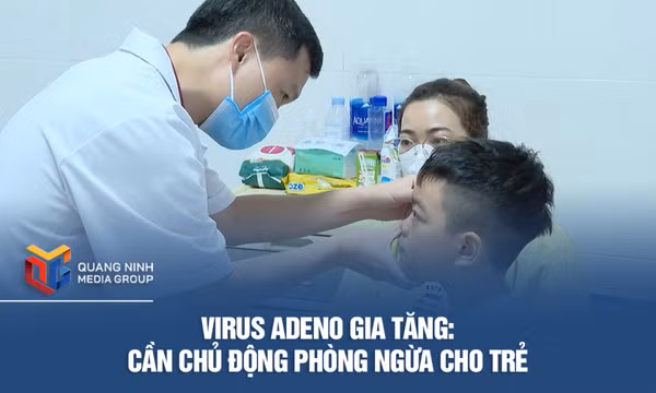 Virus Adeno gia tăng: Cần chủ động phòng ngừa cho trẻ