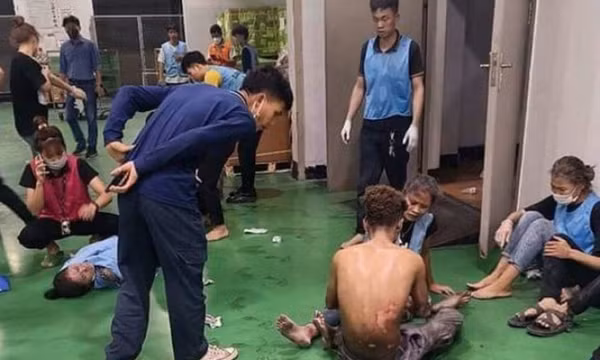 Nổ đường ống khí, 34 người bị thương