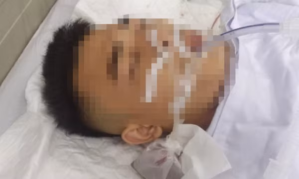 Bắt nhóm côn đồ nổ súng khiến một người trọng thương