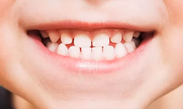 Phát triển loại thuốc giúp răng mọc lại nhiều lần