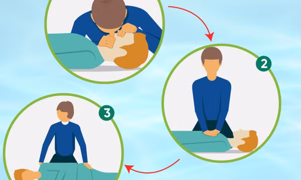 Chuyên gia hướng dẫn 5 bước sơ cứu trẻ đuối nước