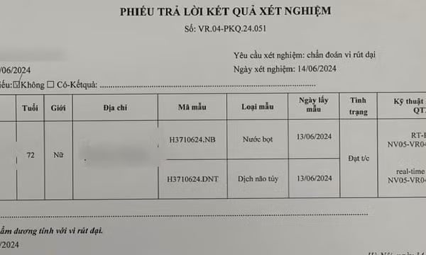 Hai tháng sau khi bị chó cắn, cụ bà nguy cơ tử vong vì bệnh dại